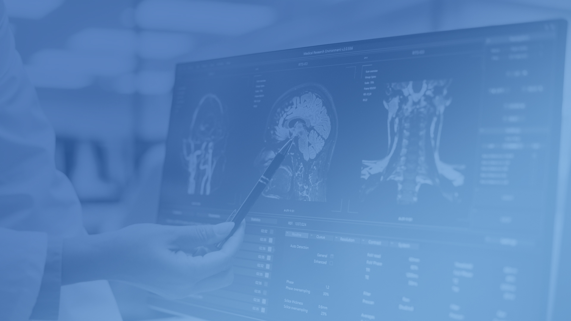 Orlando Hypoxia - Anoxic Brain Injury Lawyers